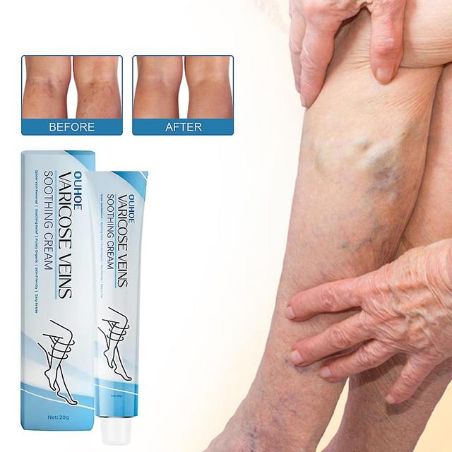 20g Vein Repair Cream for Legs Soothing Massage Leg Soreness Gel for Loose Leg Vein Legs 5pcs on Productcaster.