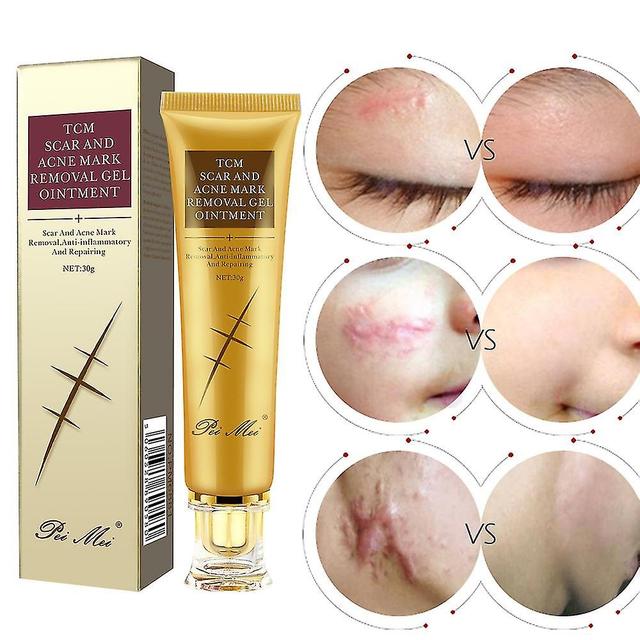 Pei Mei Scar Acne Stretch Mark Removal Ointment Gel Cream Wounds Cuts Burns on Productcaster.