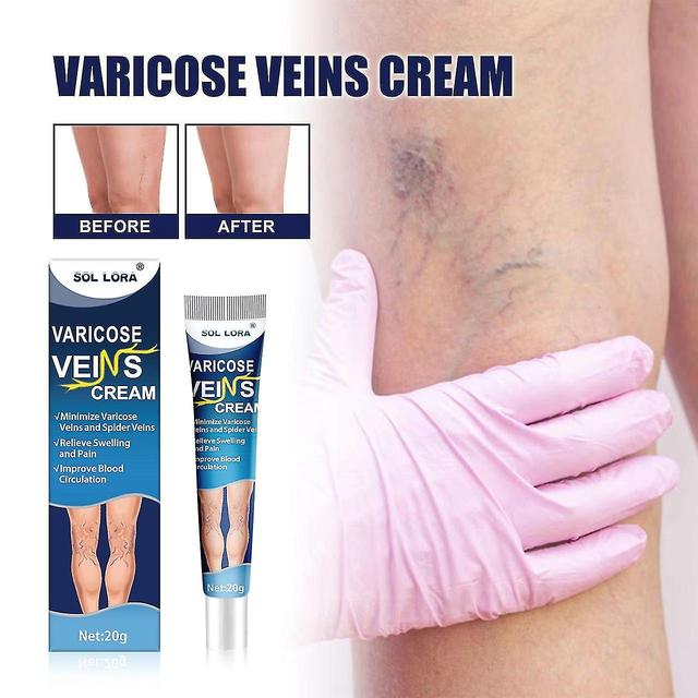 3pcs Venous Massage Varicocele Cream Relieve Leg Vascular Protruding Vein Varicocele Earthworm Leg Repair Cream on Productcaster.