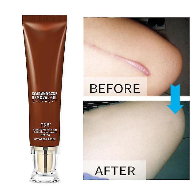 Auquest Scar Makers Removal Gel Diminish Blemishes Ointment Concealer on Productcaster.