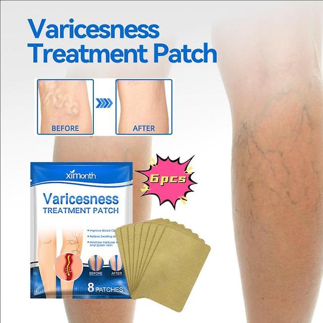 Ximonth vein care patch smoothes blood vessel bulges and massages to relieve leg varicose veins and leg swelling Massage Oil1PCS) 6PCS on Productcaster.