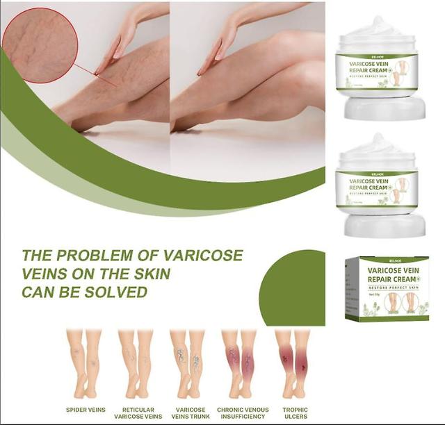 2pcs Eelhoe Vein Repair Cream Massage Les jambes Pour soulager la douleur et draguer Le méridien et les veines Soins de relaxation on Productcaster.