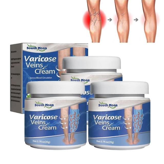 3pcs Varicose Veins Relief Repair Cream Promote Smooth Skin Blood Circulation on Productcaster.