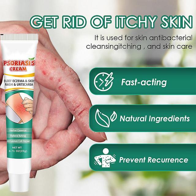 Herbal Ringworm Treatment Cream Powerful Relief Topical Itching Cream Fights Ringworm On Foot & Hand External Use Supply on Productcaster.