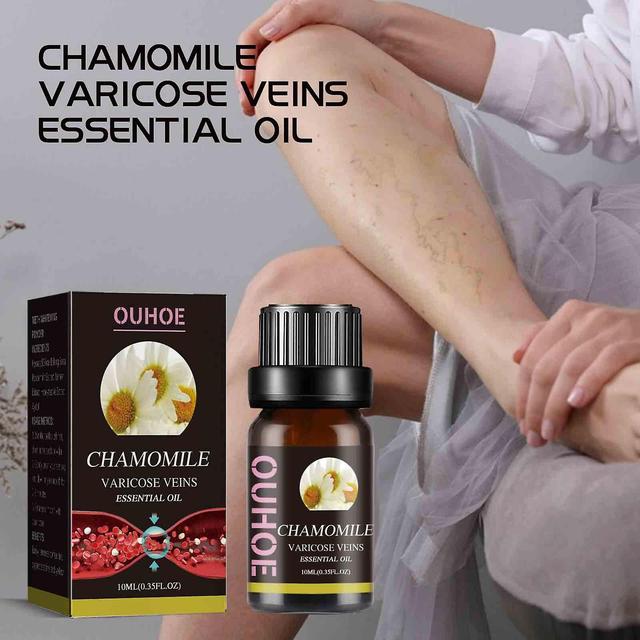 unbrand Chamomile Essential Oil For Varicose Veins, Chamomile Essential Oil For Varicose Veins, Suitable For Skin10ml Black on Productcaster.