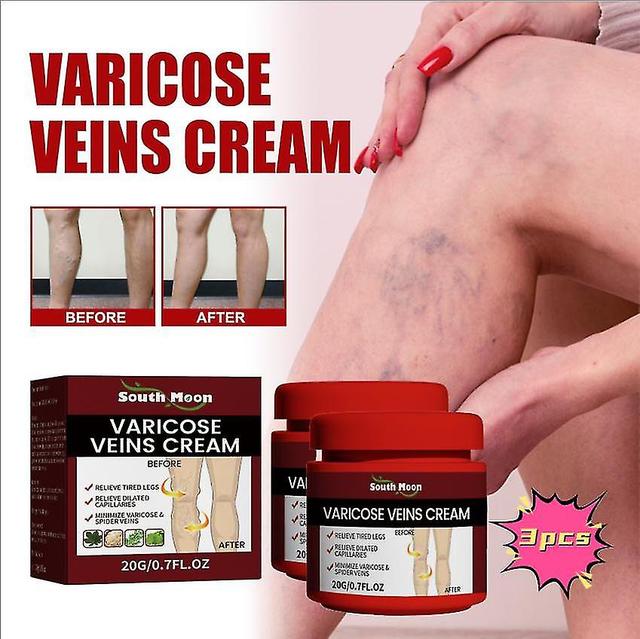 South Moon Vein Repair Cream Leg Massage Care Relieve Pain Repair Varicose Veins Body Care Cream Massage Oil1pcs) -GSL 3PCS on Productcaster.