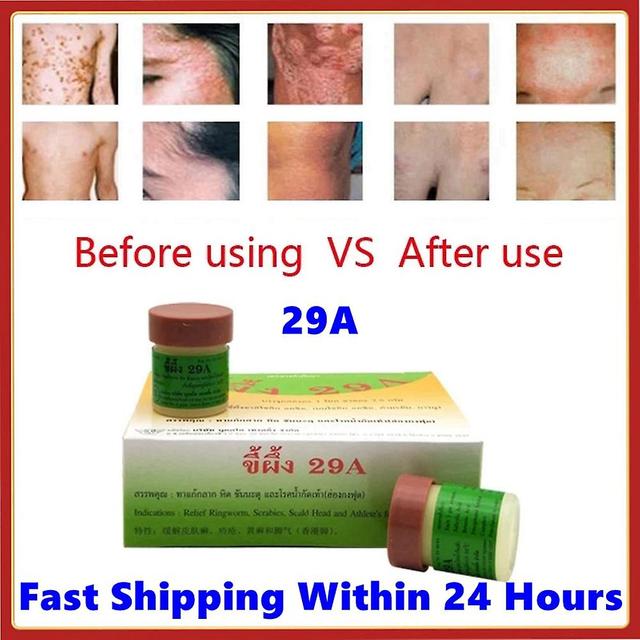 Natural Cream Of Eczma And Psoriasis, Skin Care Ointment, Perfect Work Ointment For The Skin, Dermatitis, Eczegypti, Thailand, 29a, 2 Rooms, 6/12 P... on Productcaster.