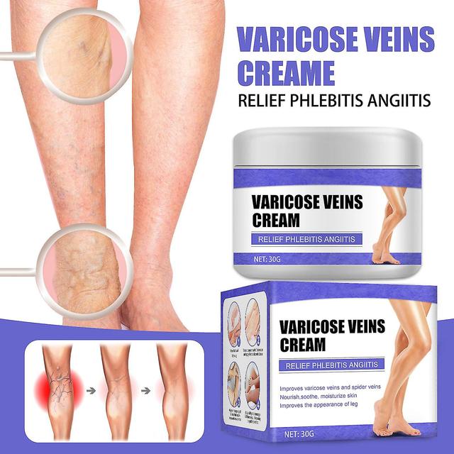 Vein Care Fading Cream, Eliminate Varicose Veins And Spider Veins, Relieve Pain Of Legs, Varicose Veins Cream 1 pcs on Productcaster.