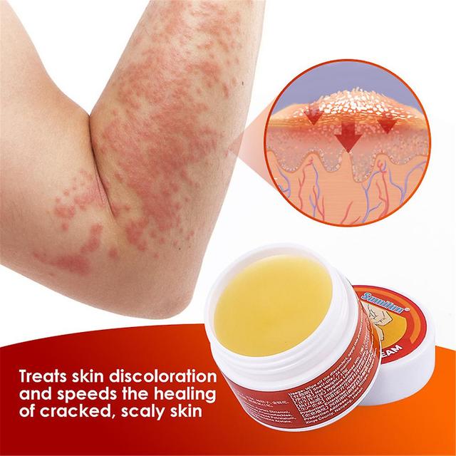 1/2pcs 10g Herbal Psoriasis Cream Joint Knee Neck Shoulder Care Cream 1PCS on Productcaster.