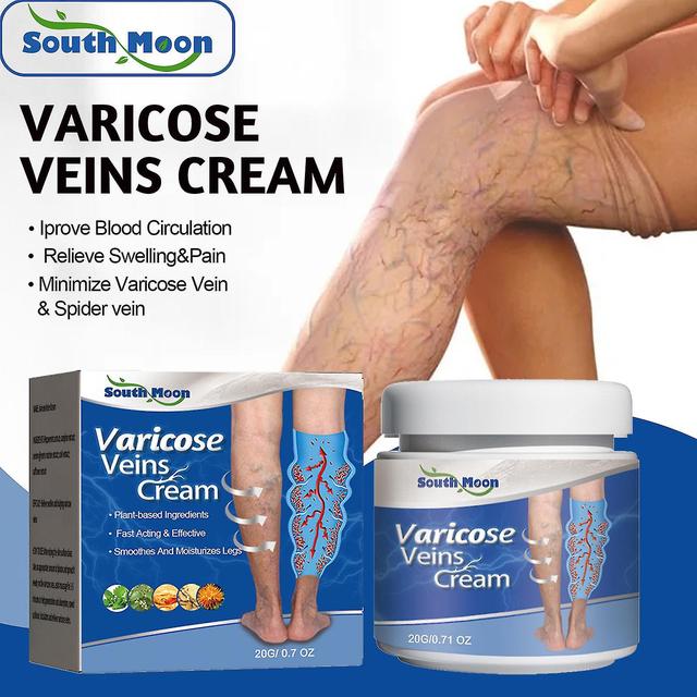 Shihaodian South Moon Venous Soothing Cream reduces spider veins, unblocks varicose veins, relieves swelling and painC5 -GSL on Productcaster.