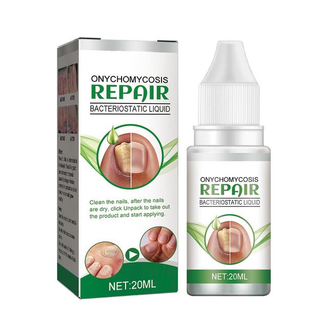 unbrand Eelhoe Ringworm Of The Nails Xiu Hu Ye Thickening Ringworm Of The Nails Xiu Hu Ye Nails Thickening 20ml Box on Productcaster.