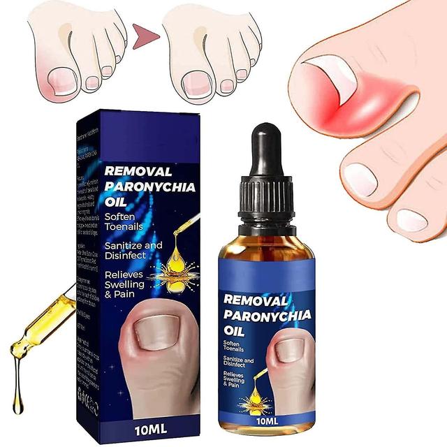 Qinfen Toe Nail Care Removal Paronychia Oil,anti Paronychia Relief Oil,toenail Anti Paronychia Relief Oil For Damaged Discolored Thick Nails 10ml 1... on Productcaster.