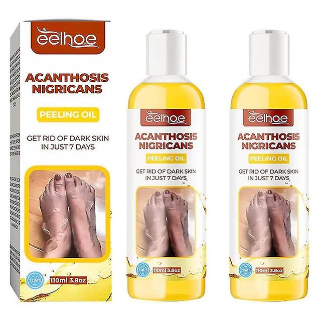 Chork Acanthosis Nigricans Peeling Oil 2pcs on Productcaster.