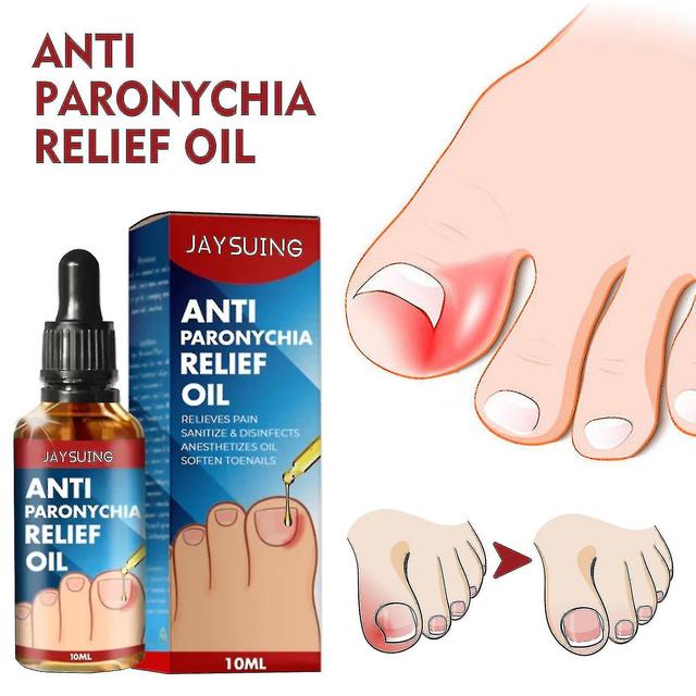 Riyan 3stk Toenailplus Anti Paronychia Relief Oil, Neglehjælper Indvækst Tåneglkorrektion Behandling Olie, Toenailplus Nailprop Anti Paronychia Rel... on Productcaster.