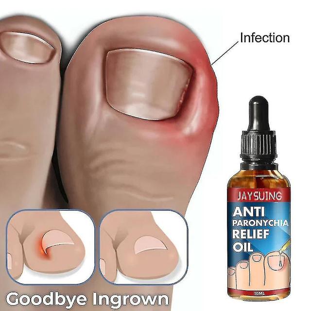 Olejek Anti Nail Break Relief Oil 10ml 1 Pcs on Productcaster.