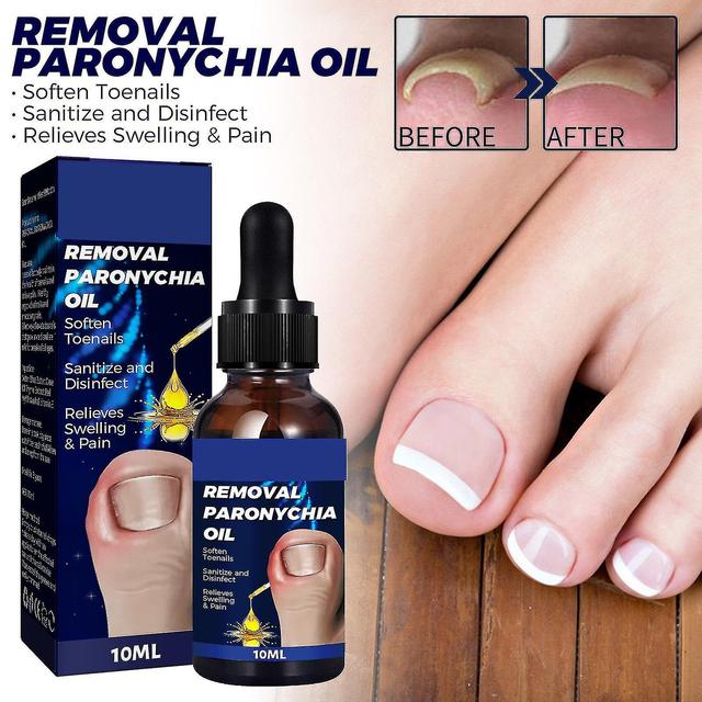 Starostlivosť o nechty na nohách Paronychia olej, Nemecké odstránenie nechtov Paronychia olej, Toenailplus Anti Paronychia Relief Oil 3pcs on Productcaster.