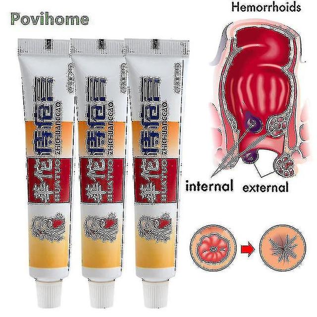 1/3/5pc Huatuo Hemorrhoid Cream Internal External Piles Chinese Herbs Ointm-yvan 3pcs wihout box on Productcaster.