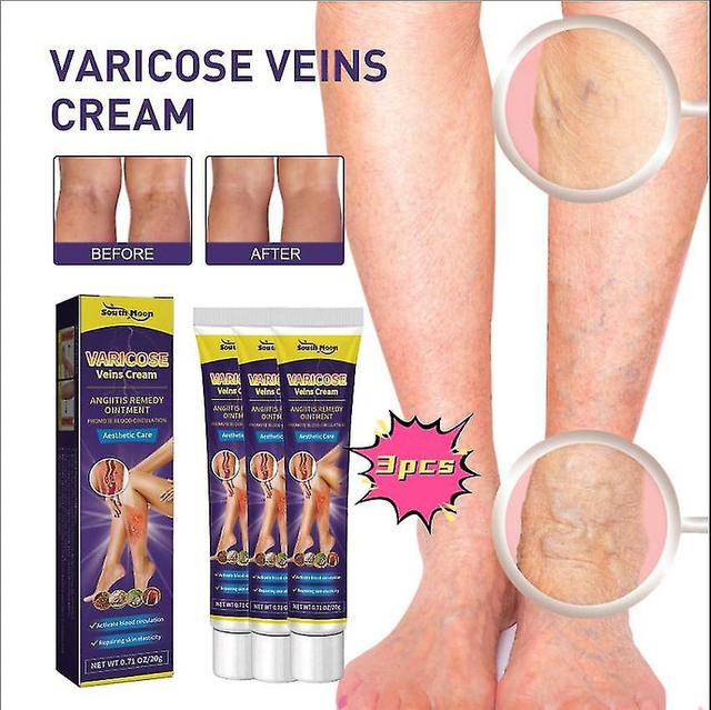 South Moon Vein Relief Cream Repairs Varicose Veins In The Legs And Relieves Swelling And Pain Of Leg Veins Massage Oil1pcs) -GSL 3PCS on Productcaster.