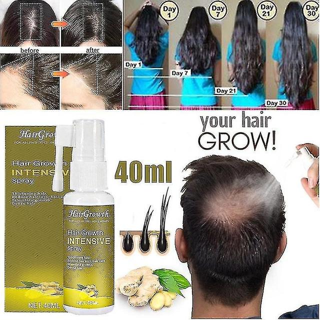 Chongchong Cabelo Crescimento Essência Beleza Crescimento Cabelo Líquido Ggrowth Eessence Oil 5/15/30/50ml on Productcaster.