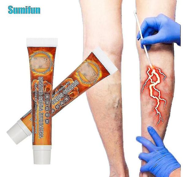 1/2pcs 20g Varicose Veins Ointmnet Vasculitis Phlebitis Spider Cream Varicosity Angiitis Removal Herbal Medical Plaster 2pcs on Productcaster.