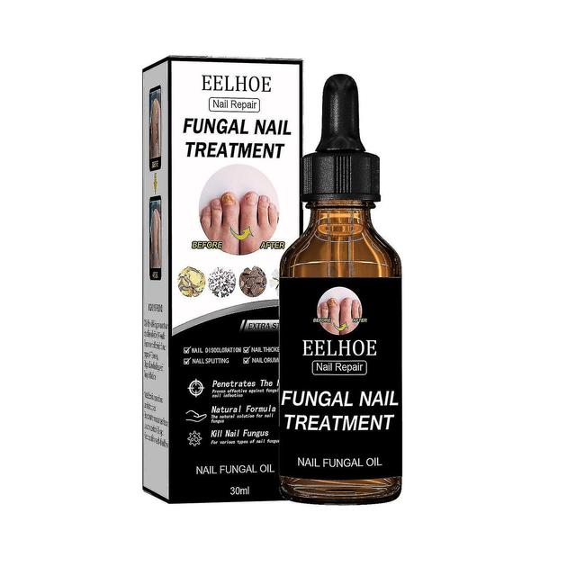 New- Eelhoe And Nails, Fungus, Dead Skin Repair, Nutrient Care style 5 on Productcaster.