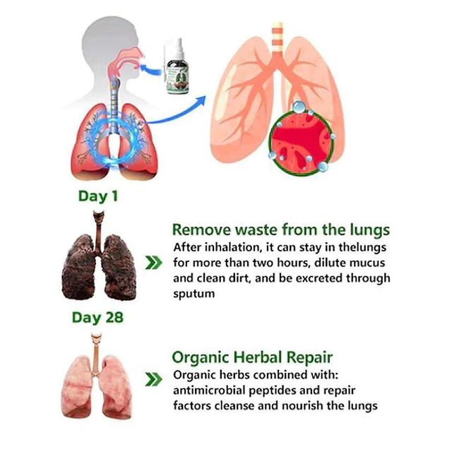 Herbal Lung Cleanse Mist, Organic Lung Health Supplement Herbal Nasal Spray For Lung Cleanse, Respiratory Support And Mucus Relief 2pcs -30ml on Productcaster.