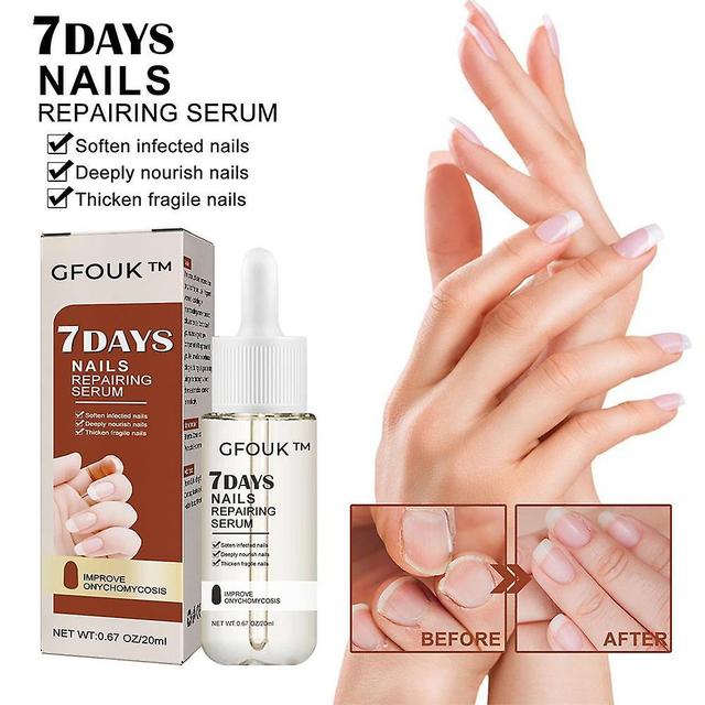 2X GFOUK 7 Days Nail Growth &Strengthening Serum,Nail Growth And Strength Serum on Productcaster.