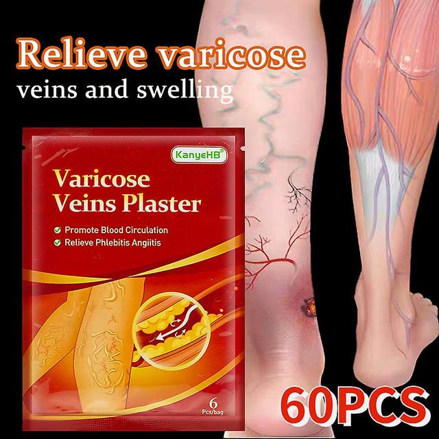 Qian 60pcs Varicose Veins Ointmnet Vasculitis Phlebitis Spider Cream Varicosity Angiitis Removal Herbal Medical Plaster Health Care 30pcs in 5 bags on Productcaster.