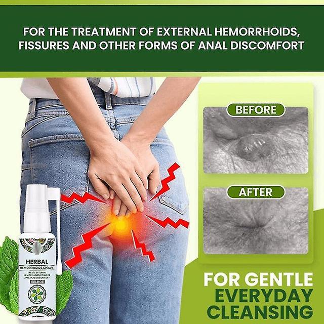 30ml Natural Herbal Hemorrhoids Spray Natural Herbal Hemorrhoids Spray Mens Gift on Productcaster.