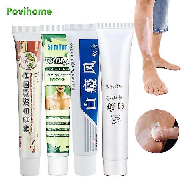 4types Vitiligo Treament Cream P1191 30g on Productcaster.