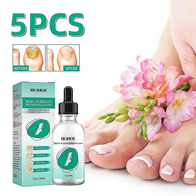 5pcs Líquido Reparador de Uñas Painlessfungus Suplemento de Aceite Esencial de Lavanda Uñas on Productcaster.