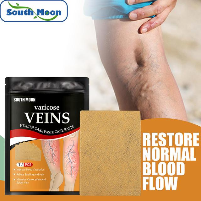 Gaoguang Varicose Vein Patch Varicose Vein Patch Spider Vein Legs Spider Vein Edema Neuralgia Leg Pain Vasculitis Promotes Circulation Mardi Gras G... on Productcaster.