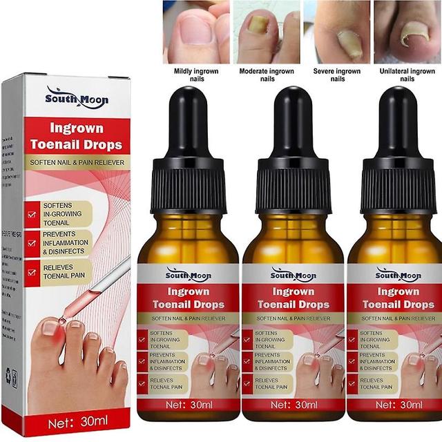 30/60/90ml Ingrowth Toenail Correction Treatment Oil Ingrown Toenail Repair Drops on Productcaster.