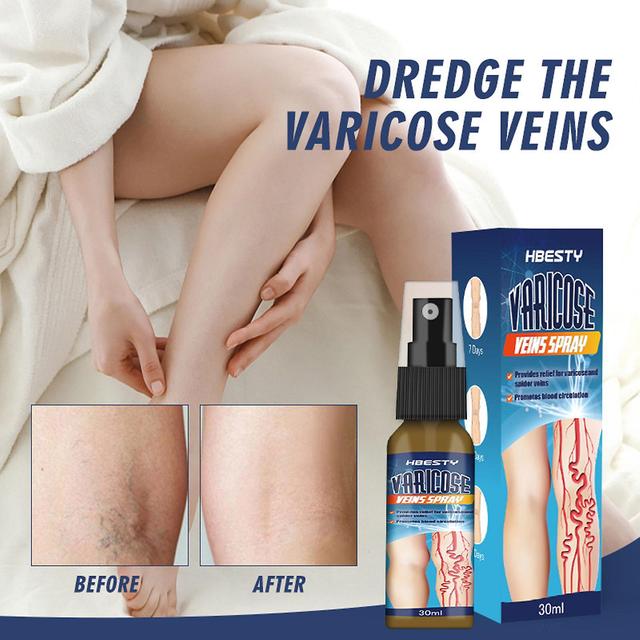 Gaoguan Varicose Vein Spray,helps Improve Circulation And Strengthen Capillary Health To Reduce Venous Congestion And Reduce The Appearance Varicos... on Productcaster.