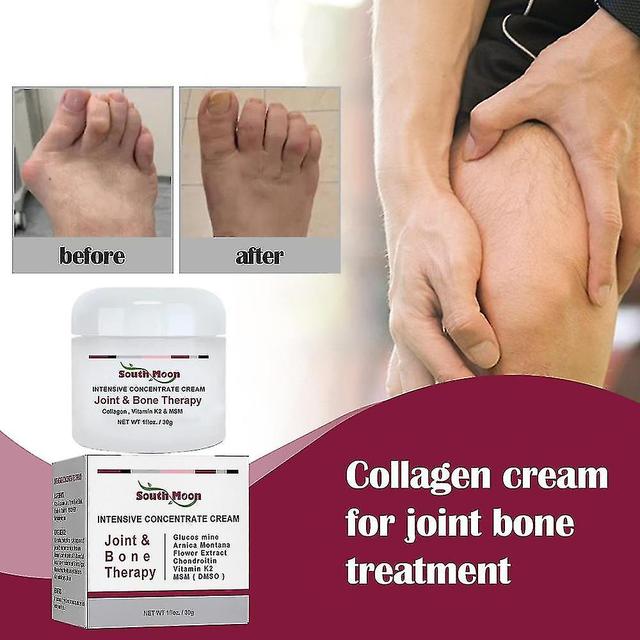 Boris Joint Bone Collagen Cream For Joint Bone Pain Relief, Deformation Correct Relieve Joint Pain white1 on Productcaster.