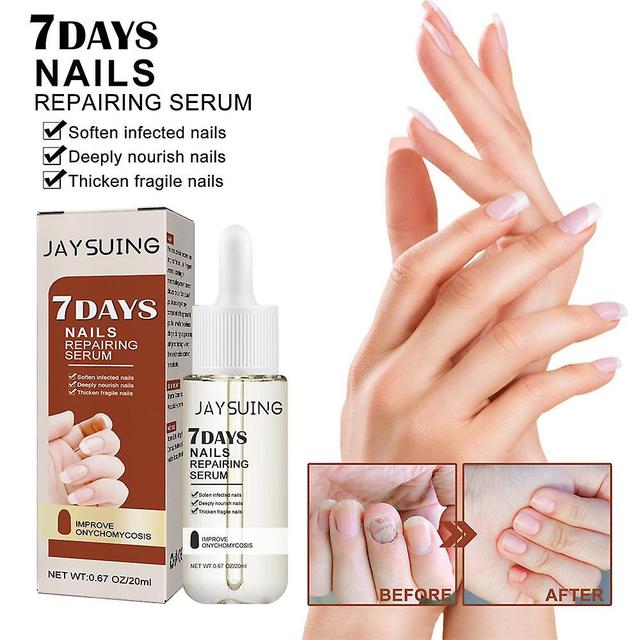 Gfouk 7 Days Nail Growth And Strengthening Serum, Nail Growth And Strength Serum on Productcaster.