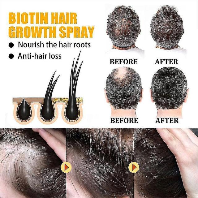 Hair Growth Products, Biotin, Fast Growing Hair Care, Essential Oil, Hair Loss Spray, Skin Nursing, on Productcaster.