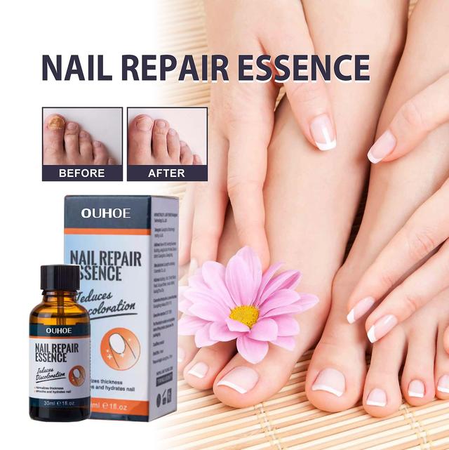 Chicoque Toenail Fungus Treatment, Extra Strength Toenail Essence and Fingernail Repair Liquid, Discolored and Damaged Nails Renew Cracked Toenail ... on Productcaster.