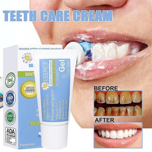 1/2st Tandblekning Care Gel Dental Plack Fläckar Borttagning Smärta Svullnad Relief Cream Mike 2PCS on Productcaster.