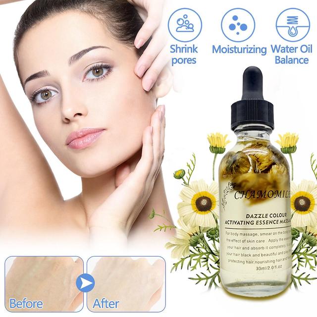 Flye Unadulterated Chamomile Dried Flower Essential Oil-Natural Smell Skin Care Multi-purpose Lasting Smell 30ml FLYE3669 Black Free Size on Productcaster.