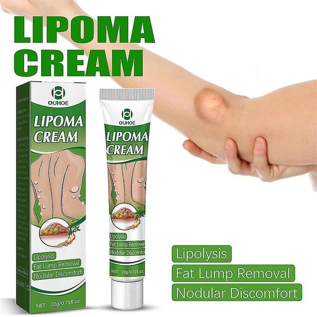 Lipoma Cream Subcutaneous Lumps Remover Treatment Medicine Liquid Apply To Skin Swelling Cellulite Fibroma Fat Mass Plaster on Productcaster.