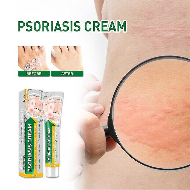 Woosien Eczema Psoriasis Cream Ointment Inflammation Natural Anti Itching Dermatitis on Productcaster.