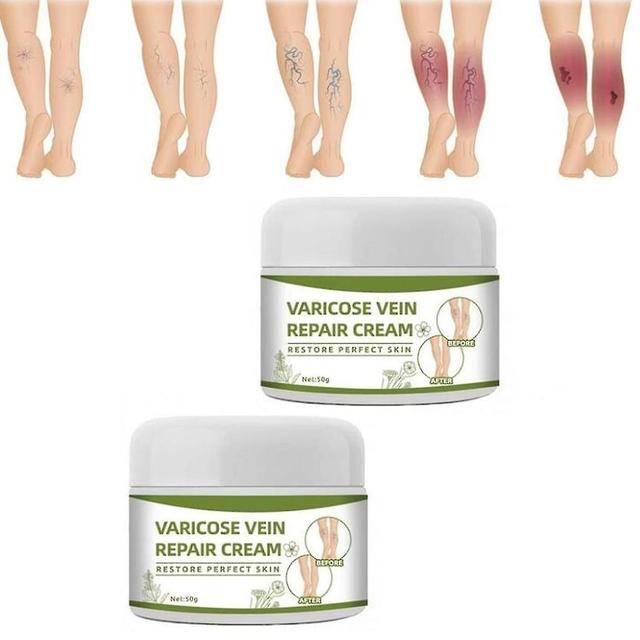 Varicose Veins Cream, Legs Care Cream, Spider Leg Repair Cream For Repairing Spider Veins, Varicose Veins And Spider Veins 2Pcs on Productcaster.