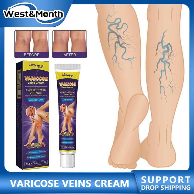 Face Anti-angite Cream For Varicose Veins, Charleroi Vein Cream, Swelling Of Bulge, Oto Repair, Earthworm, Spider Leg, Promotes Blood Overweight 20... on Productcaster.