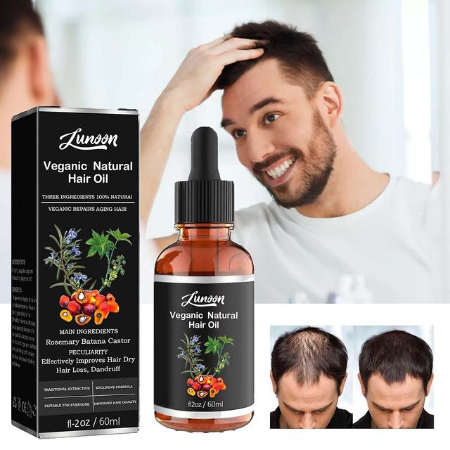 Flye Batana Oil For Health Hair,promotes Hair Wellness For Men & Womenenhances Hair & Skin Radiance,leaves Your Hair Smoother Oil 60ml 20231120 Fly... on Productcaster.