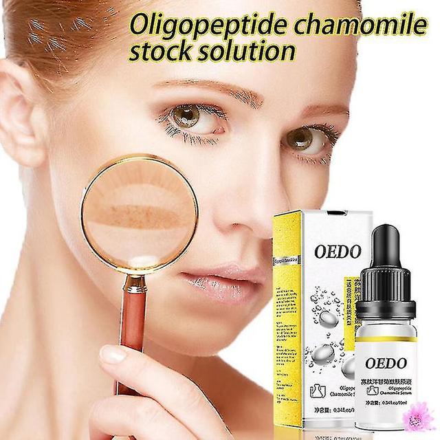 Buy 1 Get 1 Freeoligopeptide Chamomile Essence With Chamomile Extract Moisturizing Your Skin Fading Winkles Suit For on Productcaster.