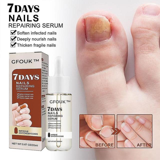 2x Gfouk 7 Days Nail Growth And Strengthening Serum on Productcaster.