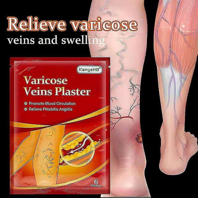 18/30/42/60pcs Varicose Veins Ointmnet Vasculitis Phlebitis Spider Cream Varicos 30pcs in 5 bags on Productcaster.