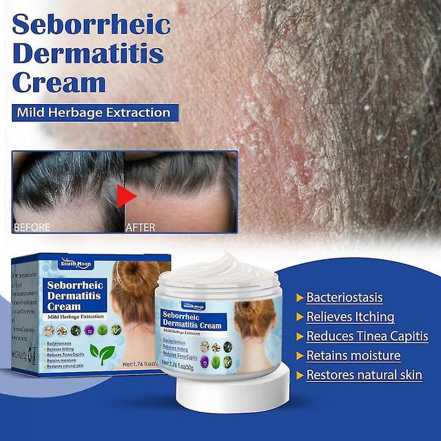 Seborrheic Skin Cream Hoofd Acne Pruritus Hoofdhuid Ringworm Huid Probleem Reparatie on Productcaster.