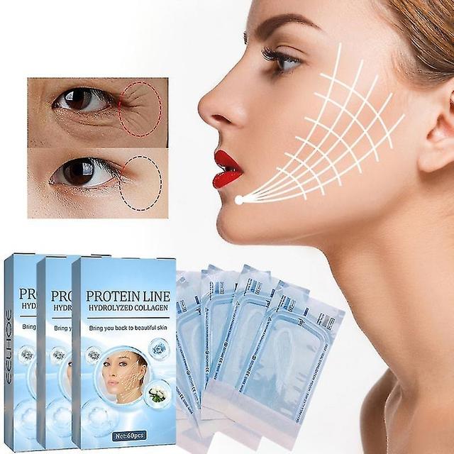 180pcs Protein Thread No Needle Gold Protein Line Absorbable Collagen For Facial Lift Anti Aging Hya on Productcaster.